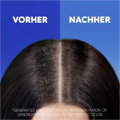 Anti-Schuppen Shampoo Apple Fresh -Exquisite Pflege MAM 10410792 SHOP IMAGE 1.4