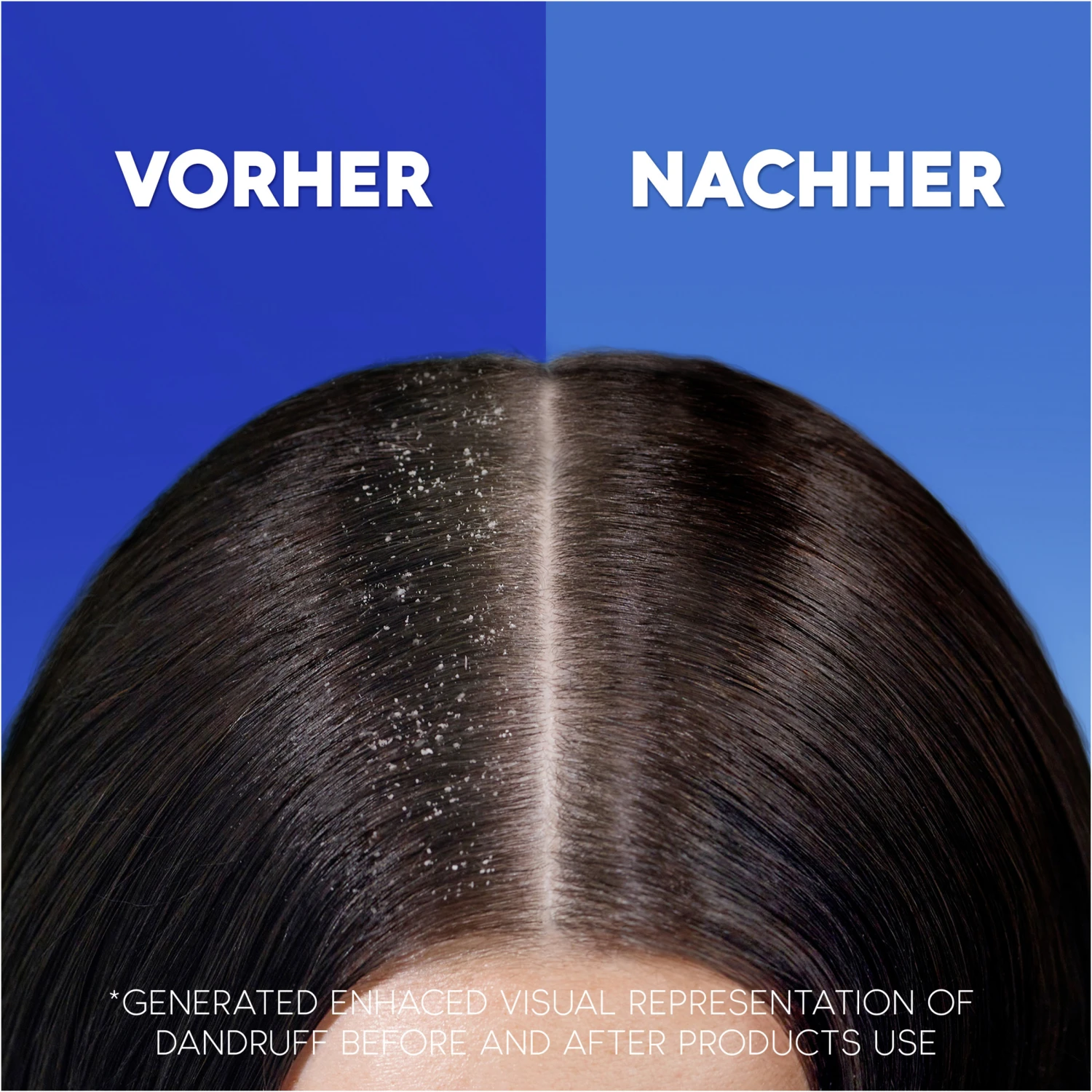 Haarshampoo Anti-Schuppen Classic Clean 3 Haarshampoo Anti-Schuppen Classic Clean – Bild 3