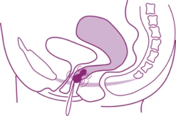 Beckenboden-Trainingshilfe – Phase II -Exquisite Pflege MAM 3810414 SHOP IMAGE 1.4